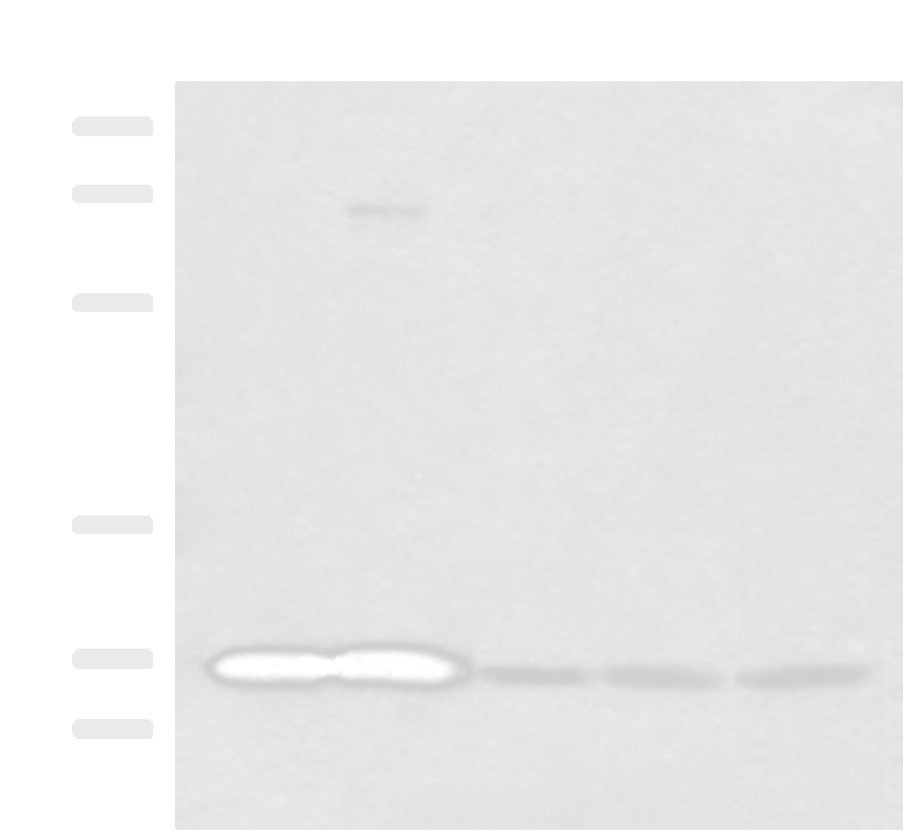 Western blot analysis of Human cerebella tissue Human cerebrum tissue Human skin tissue NIH/3T3 cell SKOV3 cell lysates  using OVOL2 Polyclonal Antibody at dilution of 1:350