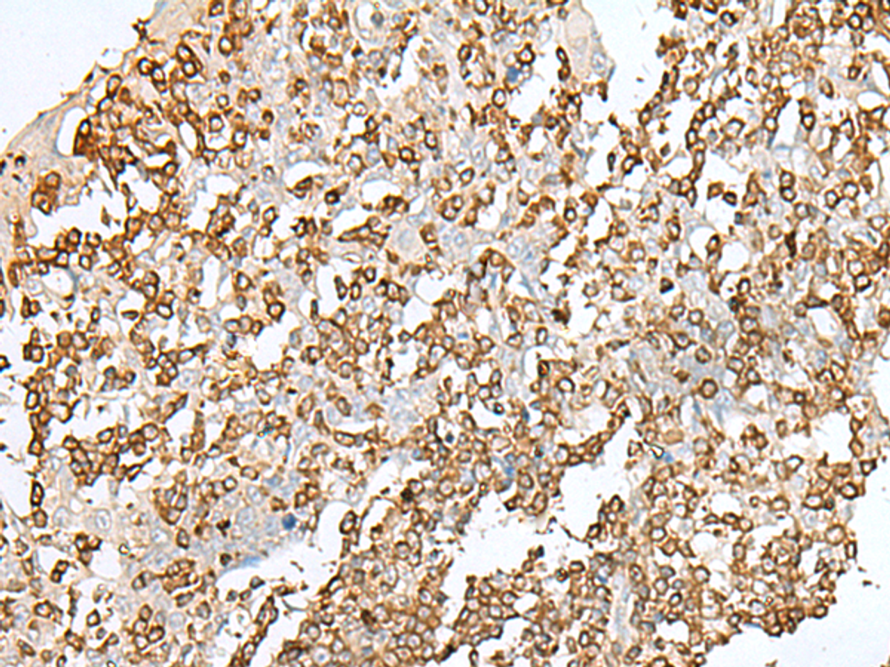 Immunohistochemistry of paraffin-embedded Human tonsil tissue  using SEPT1 Polyclonal Antibody at dilution of 1:50(×200)