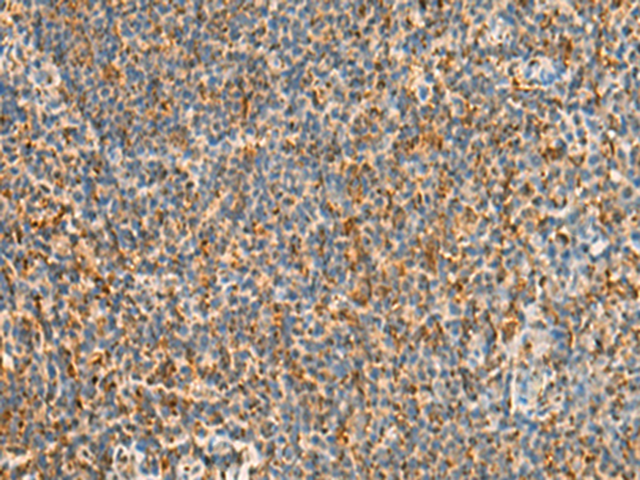 Immunohistochemistry of paraffin-embedded Human tonsil tissue  using STK32C Polyclonal Antibody at dilution of 1:40(×200)