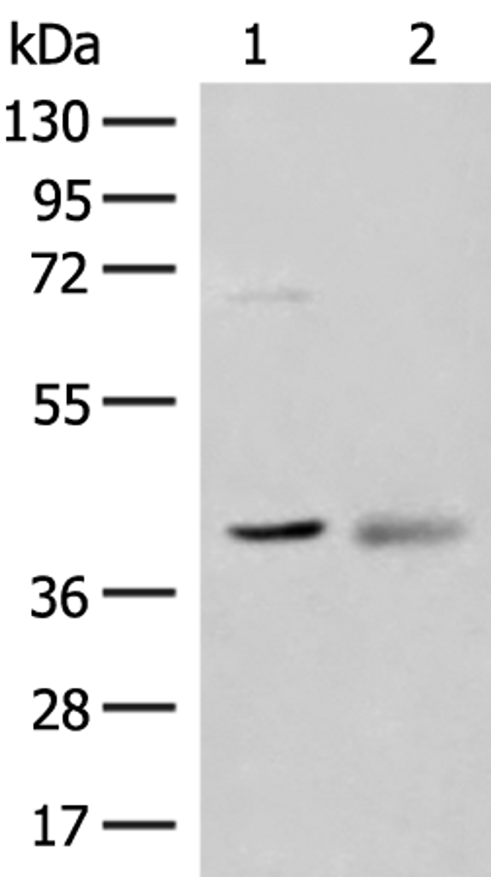 Western blot analysis of Mouse kidney tissue and Human fetal brain tissue lysates  using ADH5 Polyclonal Antibody at dilution of 1:500
