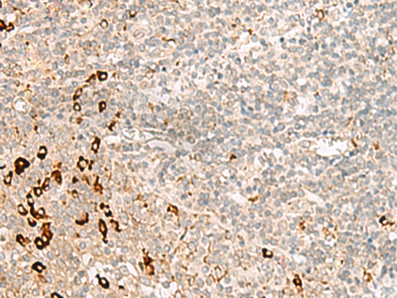 Immunohistochemistry of paraffin-embedded Human tonsil tissue  using RMND5A Polyclonal Antibody at dilution of 1:50(×200)