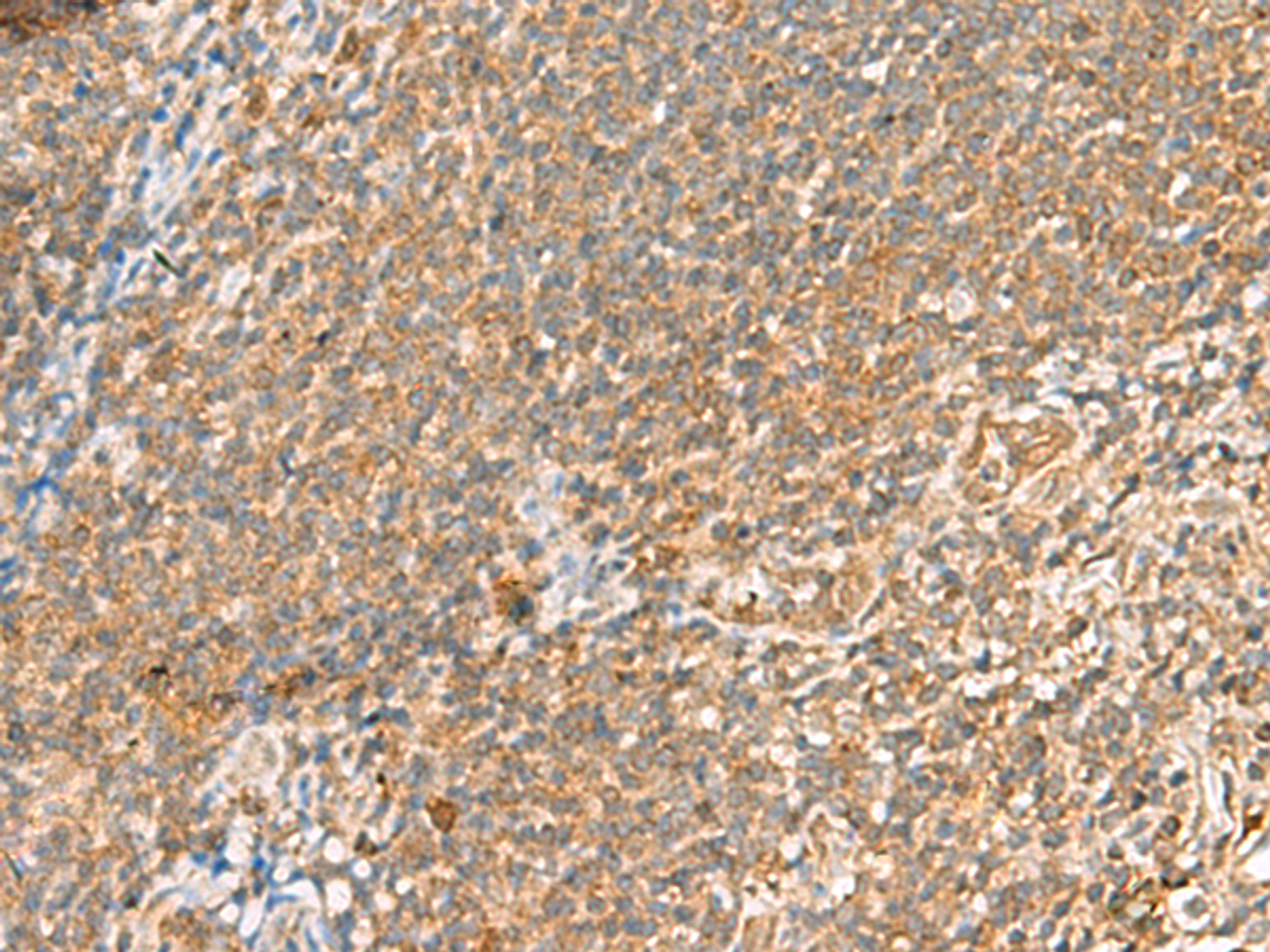 Immunohistochemistry of paraffin-embedded Human tonsil tissue  using SCRN2 Polyclonal Antibody at dilution of 1:60(×200)