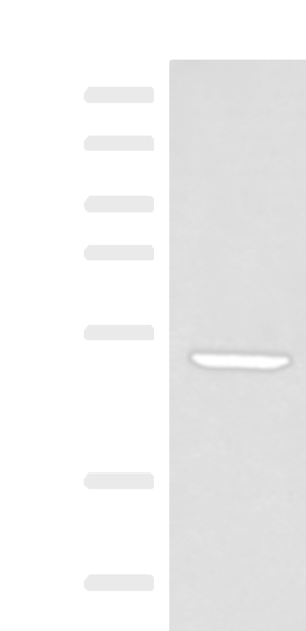 Western blot analysis of Rat heart tissue lysate  using PSMD12 Polyclonal Antibody at dilution of 1:300