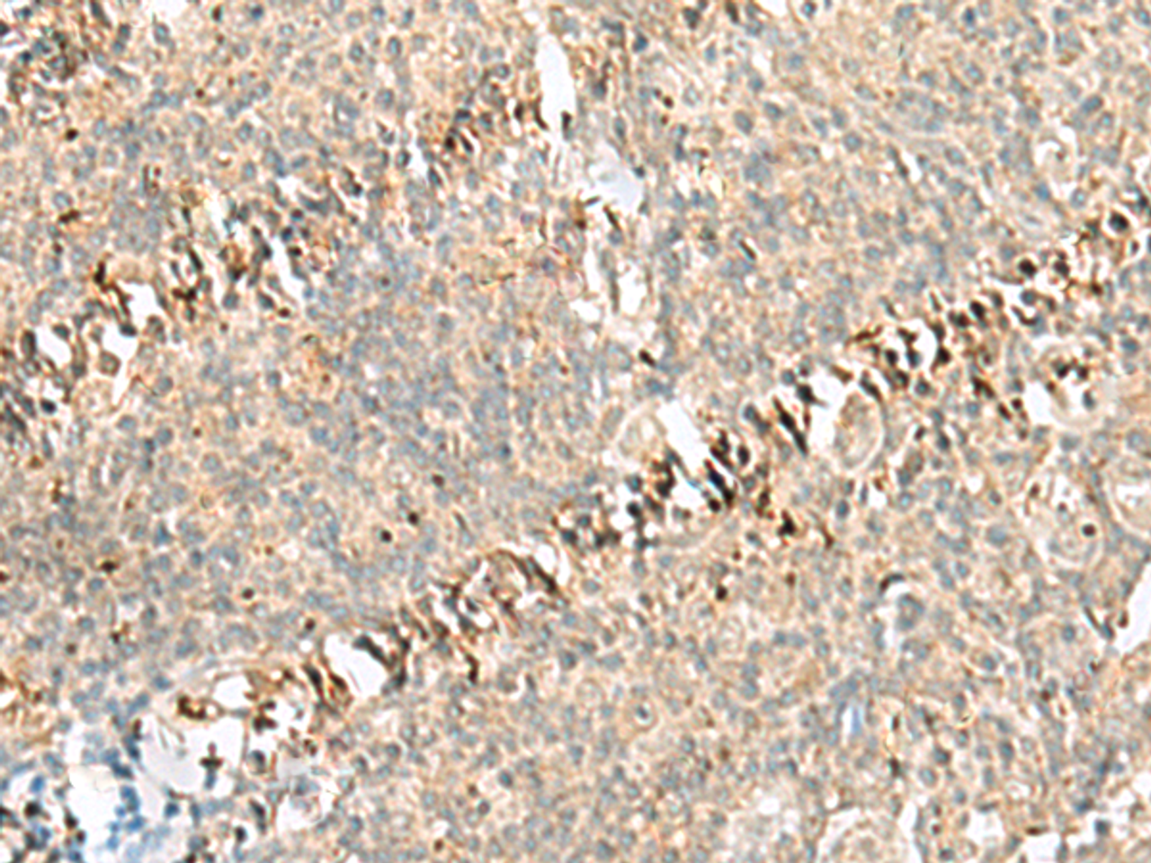 Immunohistochemistry of paraffin-embedded Human tonsil tissue  using RABGGTA Polyclonal Antibody at dilution of 1:50(×200)
