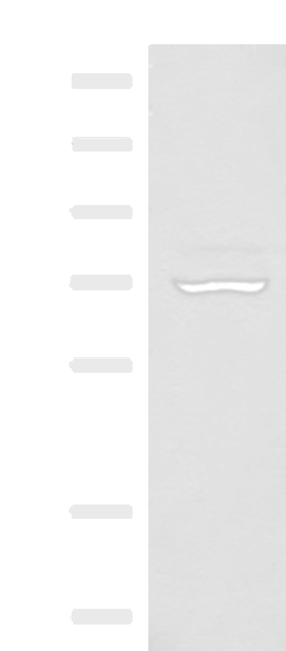 Western blot analysis of 293T cell lysate  using EIF2AK1 Polyclonal Antibody at dilution of 1:350
