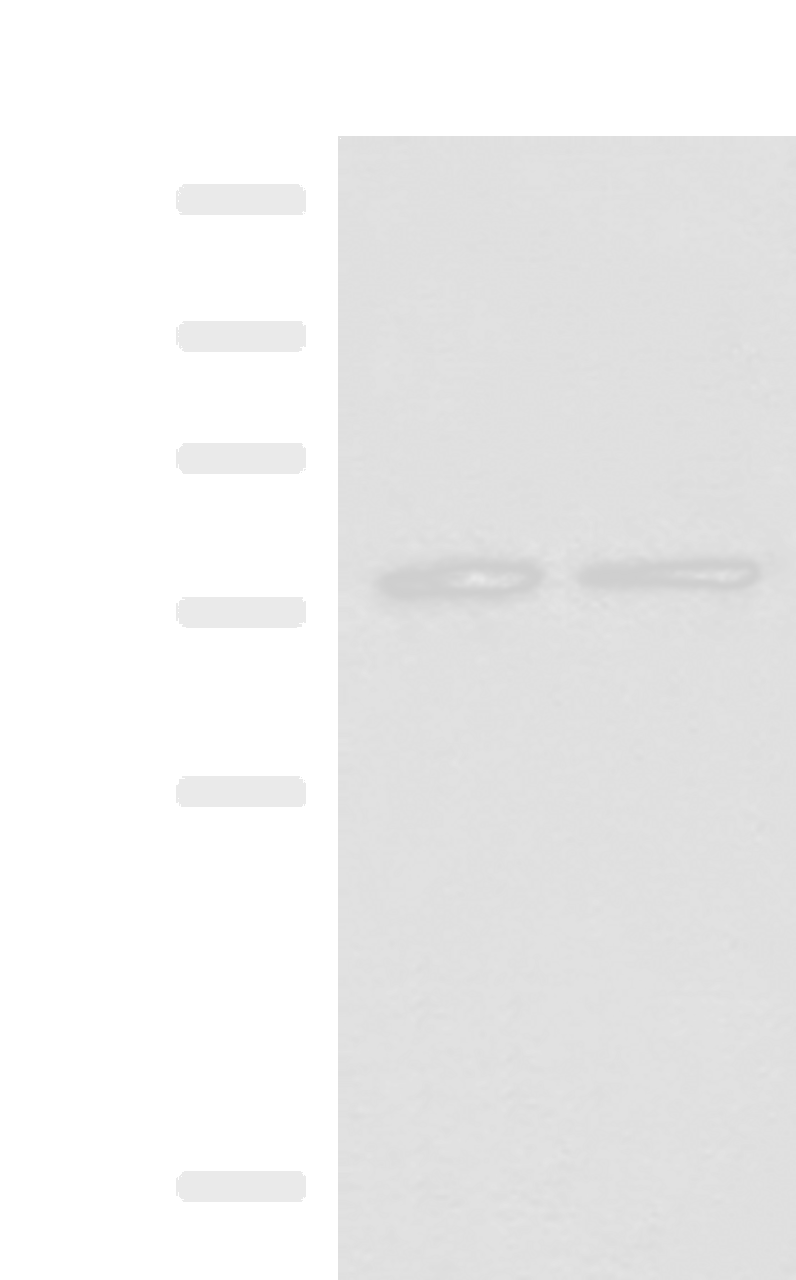 Western blot analysis of RAW264.7 and NIH/3T3 cell lysates  using PDIA4 Polyclonal Antibody at dilution of 1:250