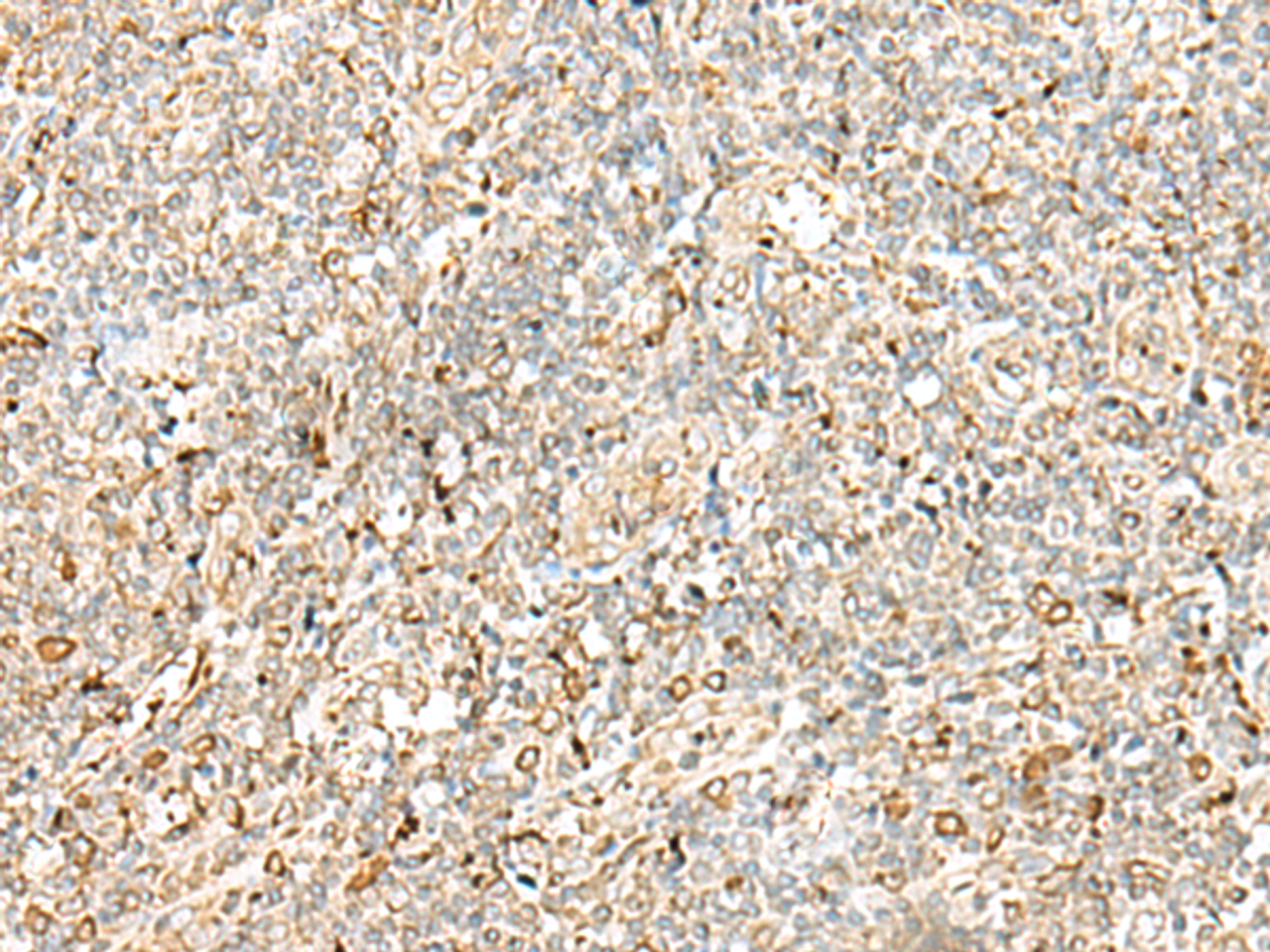 Immunohistochemistry of paraffin-embedded Human tonsil tissue  using PDIA4 Polyclonal Antibody at dilution of 1:40(×200)