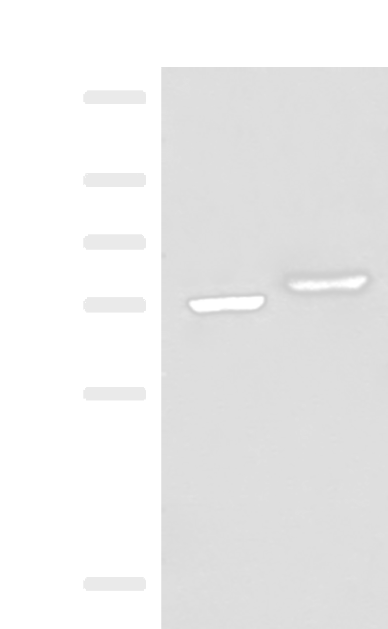 Western blot analysis of A172 and HepG2 cell lysates  using POMGNT1 Polyclonal Antibody at dilution of 1:400