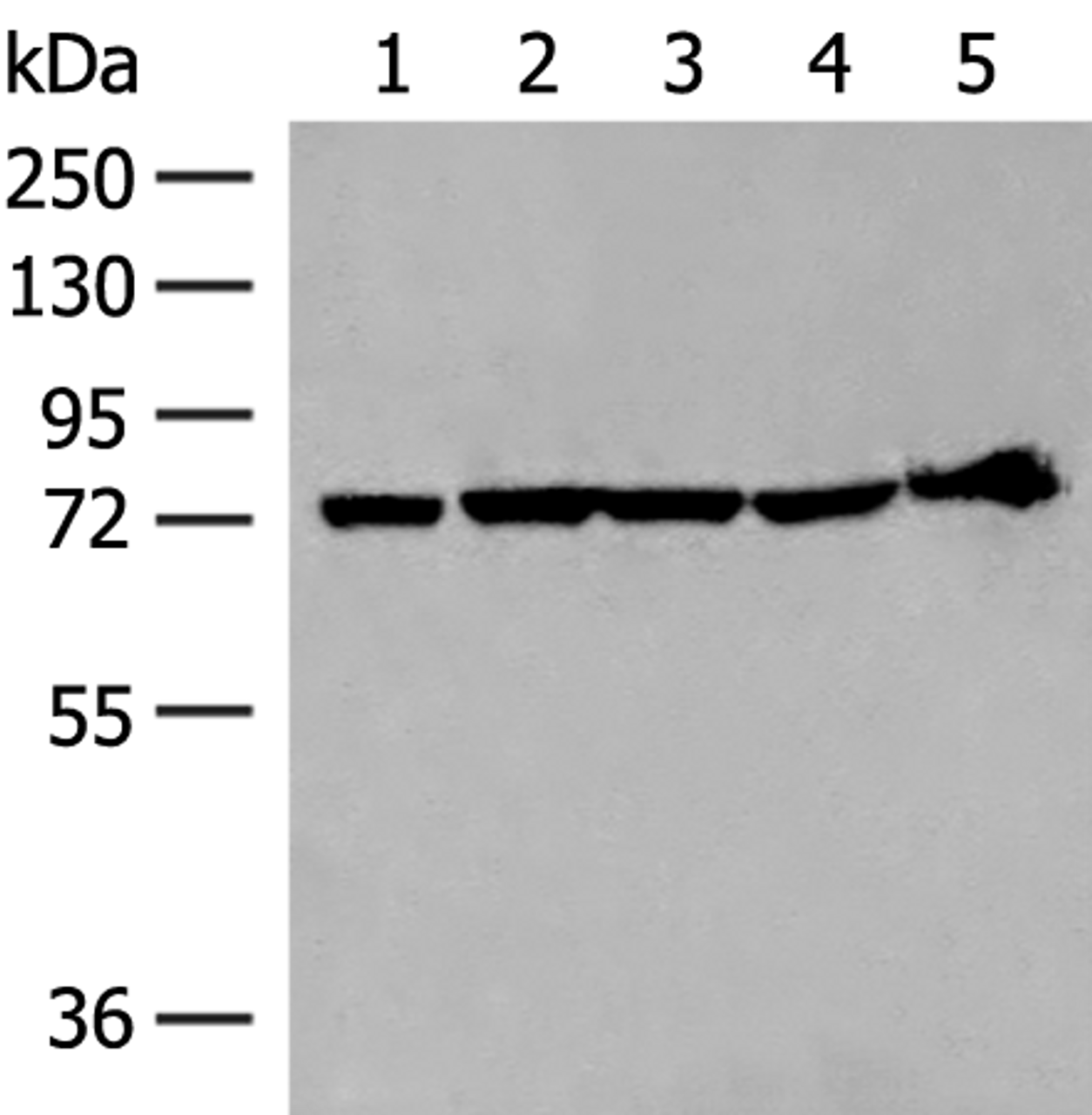 Western blot analysis of 293T cell and Mouse heart tissue lysates  using CALCOCO1 Polyclonal Antibody at dilution of 1:300