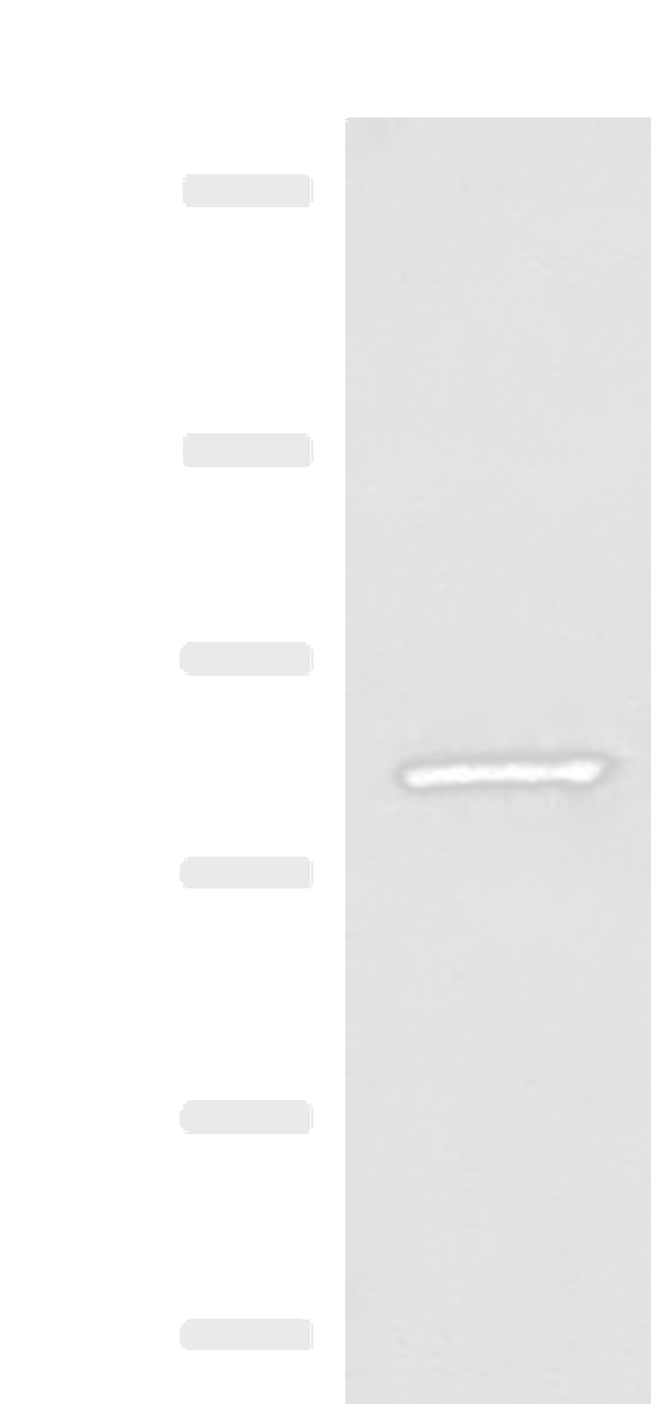 Western blot analysis of Human hepatocellular carcinoma tissue lysate  using SLC26A3 Polyclonal Antibody at dilution of 1:250