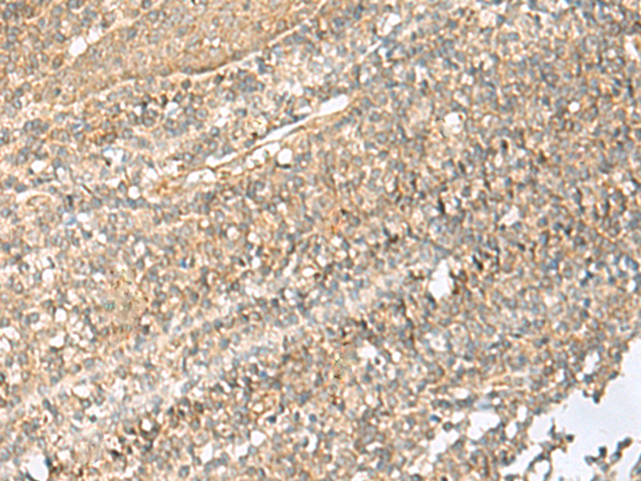 Immunohistochemistry of paraffin-embedded Human tonsil tissue  using NID2 Polyclonal Antibody at dilution of 1:70(×200)