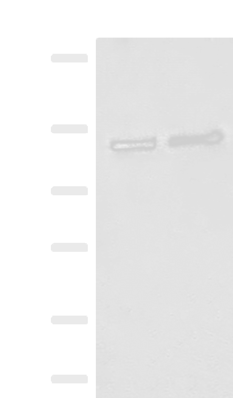 Western blot analysis of K562 cell Human fetal brain tissue lysates  using IPO11 Polyclonal Antibody at dilution of 1:500