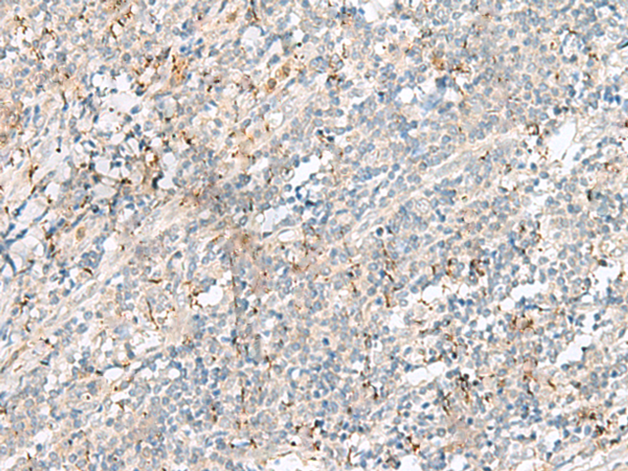 Immunohistochemistry of paraffin-embedded Human tonsil tissue  using PLCL2 Polyclonal Antibody at dilution of 1:50(×200)