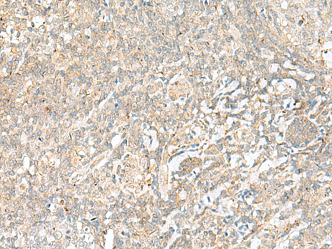 Immunohistochemistry of paraffin-embedded Human tonsil tissue  using BEX2 Polyclonal Antibody at dilution of 1:45(×200)