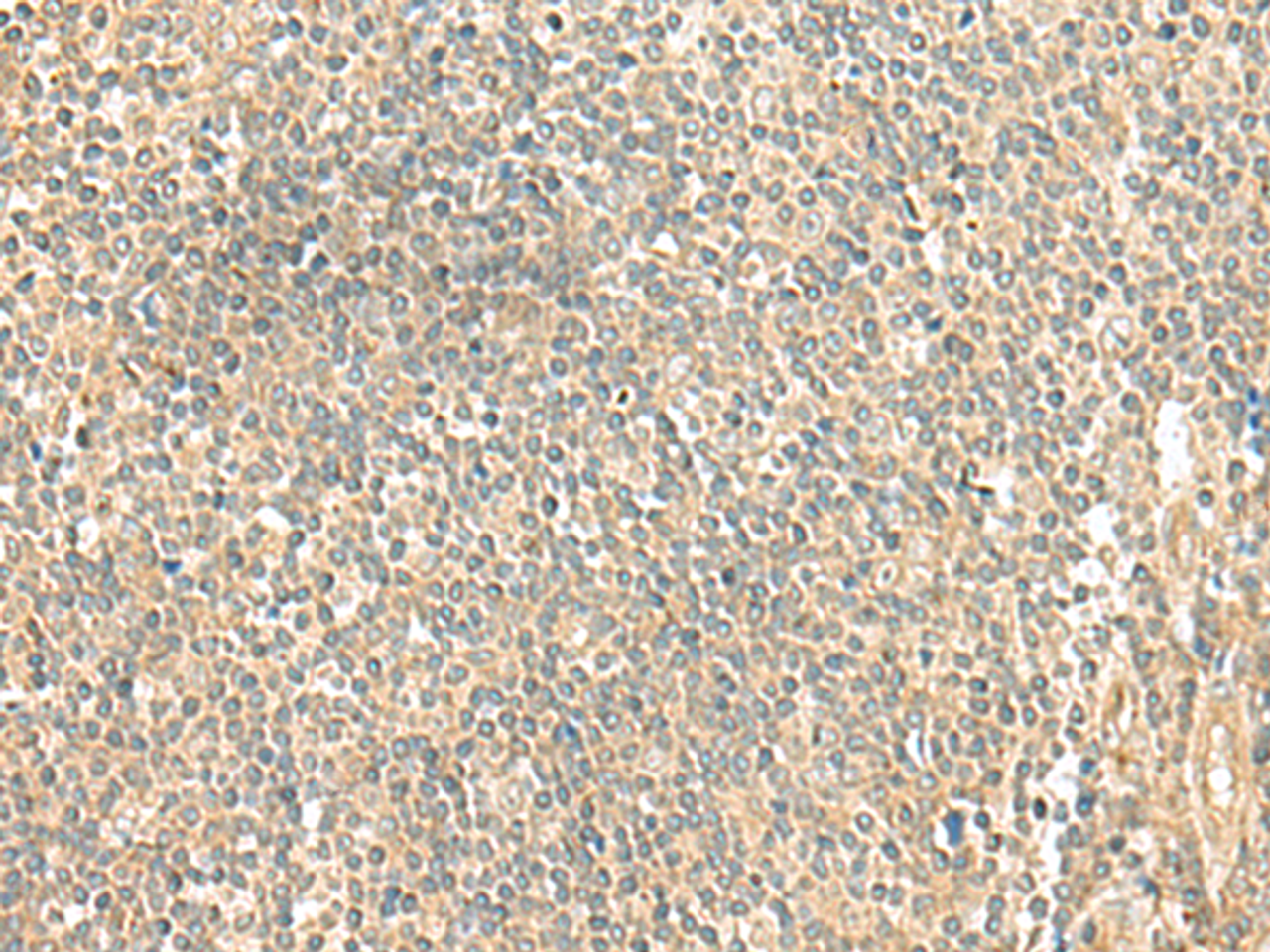 Immunohistochemistry of paraffin-embedded Human tonsil tissue  using LMO3 Polyclonal Antibody at dilution of 1:50(×200)