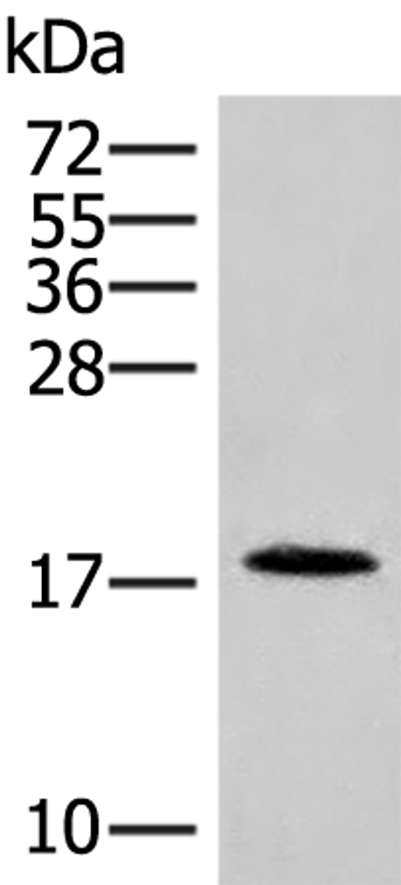 Western blot analysis of Human spleen tissue lysate  using NHP2 Polyclonal Antibody at dilution of 1:400