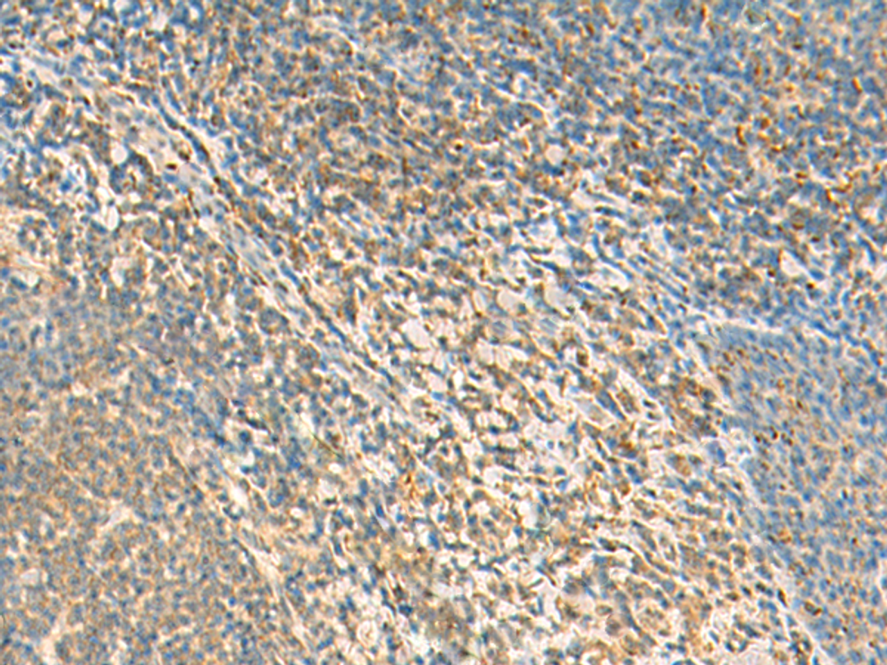 Immunohistochemistry of paraffin-embedded Human tonsil tissue  using TXNDC12 Polyclonal Antibody at dilution of 1:50(×200)