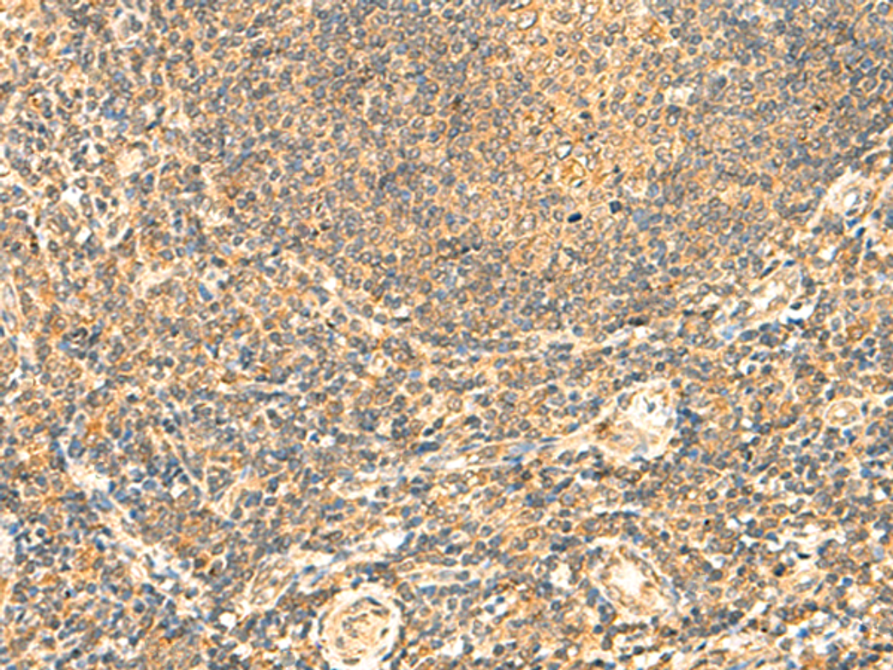Immunohistochemistry of paraffin-embedded Human tonsil tissue  using LYZL1 Polyclonal Antibody at dilution of 1:50(×200)