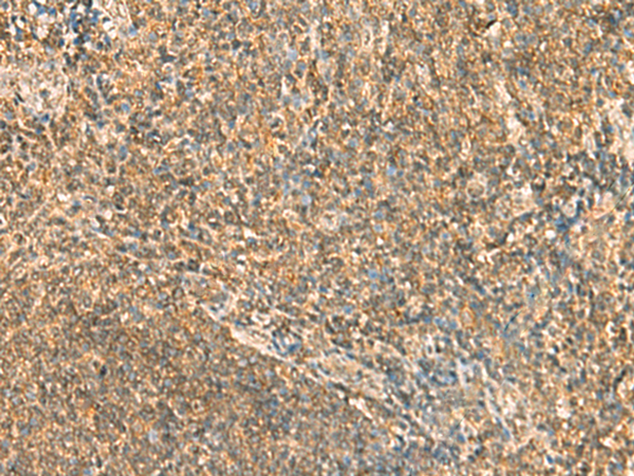 Immunohistochemistry of paraffin-embedded Human tonsil tissue  using SSSCA1 Polyclonal Antibody at dilution of 1:50(×200)