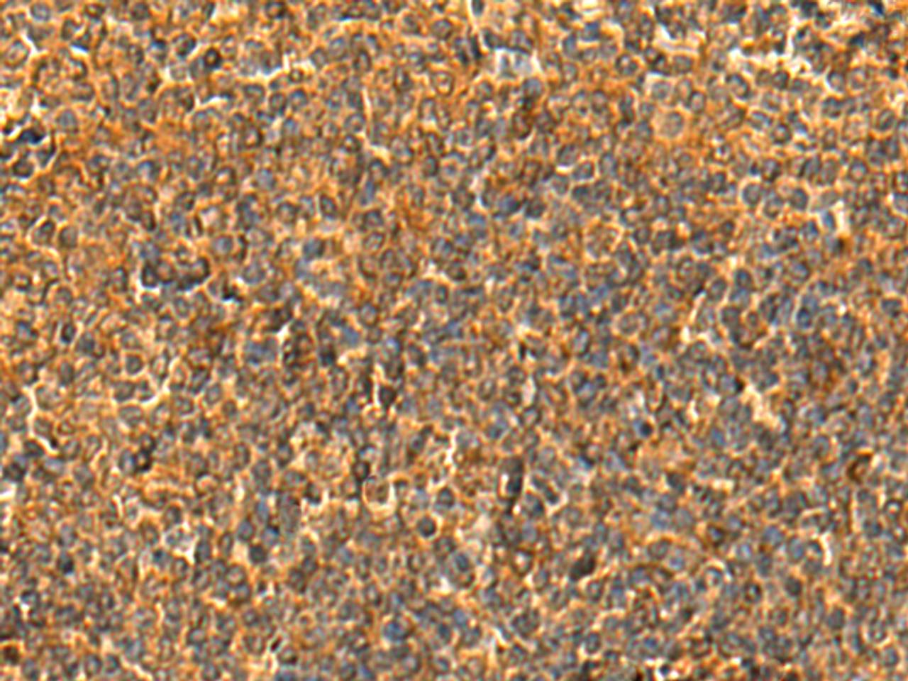 Immunohistochemistry of paraffin-embedded Human tonsil tissue  using HS1BP3 Polyclonal Antibody at dilution of 1:50(×200)