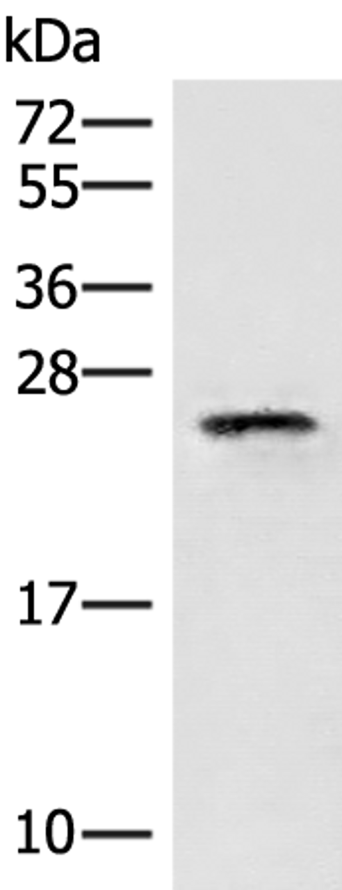 Western blot analysis of HT29 cell lysate  using EIF3K Polyclonal Antibody at dilution of 1:400
