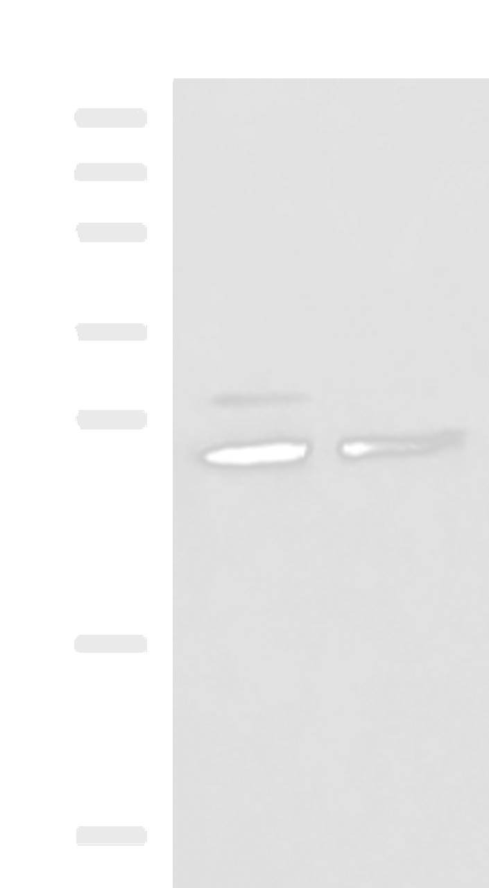 Western blot analysis of Hela and K562 cell lysates  using SNRPB2 Polyclonal Antibody at dilution of 1:1600