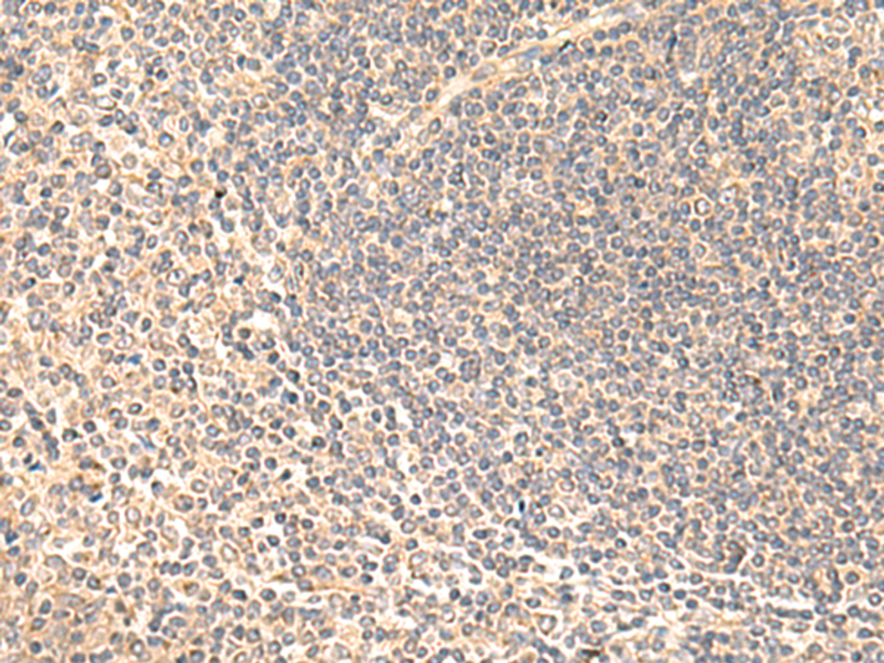 Immunohistochemistry of paraffin-embedded Human tonsil tissue  using SULT4A1 Polyclonal Antibody at dilution of 1:65(×200)