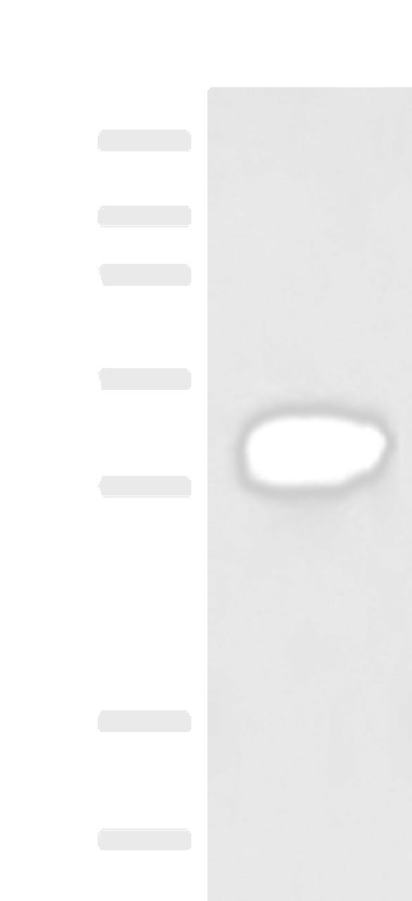 Western blot analysis of HepG2 cell lysate  using HCCS Polyclonal Antibody at dilution of 1:4000