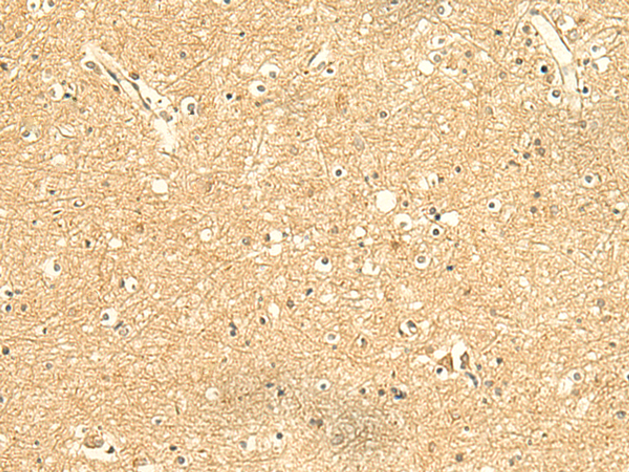 Immunohistochemistry of paraffin-embedded Human brain tissue  using KIAA0513 Polyclonal Antibody at dilution of 1:50(×200)
