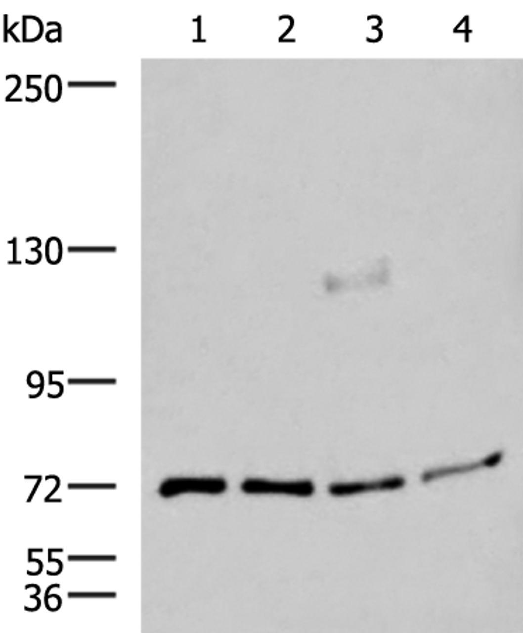 Western blot analysis of A549 A172 TM4 and PC3 cell lysates  using ASTE1 Polyclonal Antibody at dilution of 1:600
