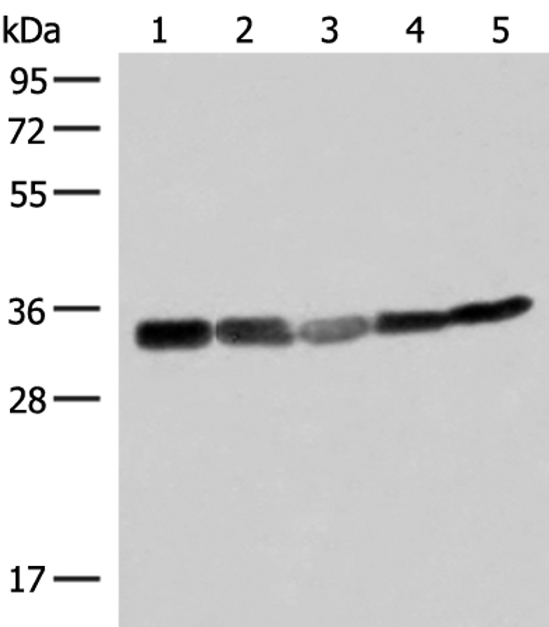 Western blot analysis of 293T HepG2 and A549 cell lysates  using ECH1 Polyclonal Antibody at dilution of 1:200