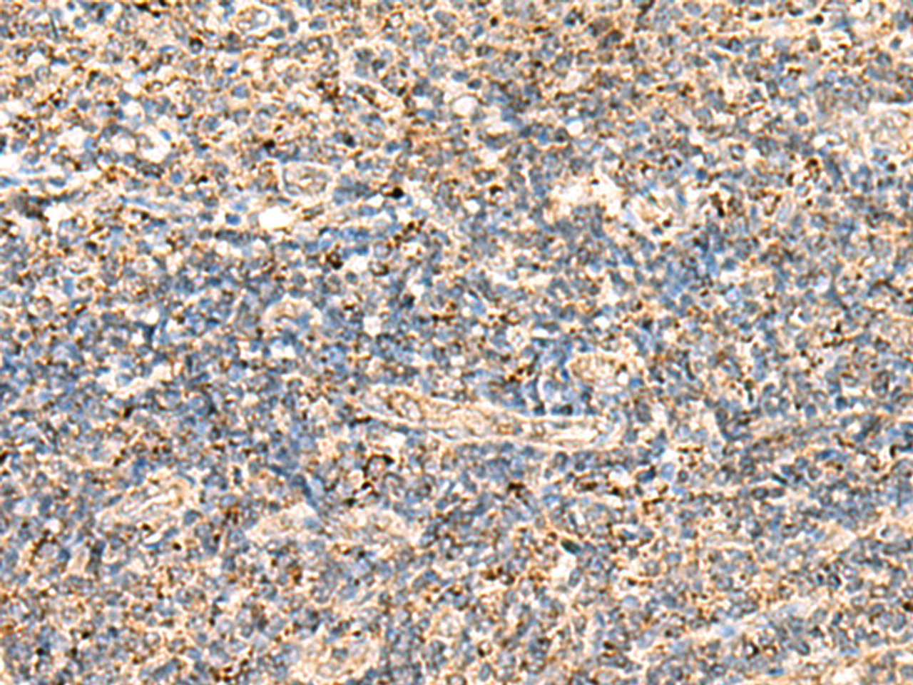 Immunohistochemistry of paraffin-embedded Human tonsil tissue  using ECH1 Polyclonal Antibody at dilution of 1:50(×200)