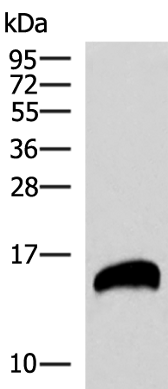 Western blot analysis of Human pancreas tissues lysate  using REG1B Polyclonal Antibody at dilution of 1:800