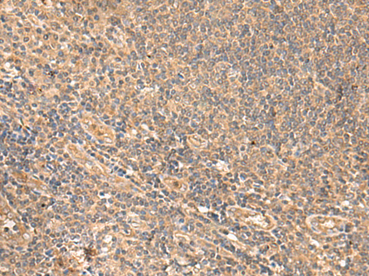 Immunohistochemistry of paraffin-embedded Human tonsil tissue  using MEST Polyclonal Antibody at dilution of 1:65(×200)