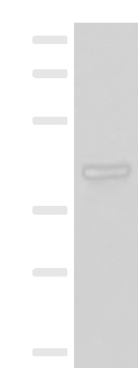 Western blot analysis of Mouse lung tissue lysates  using LMCD1 Polyclonal Antibody at dilution of 1:550