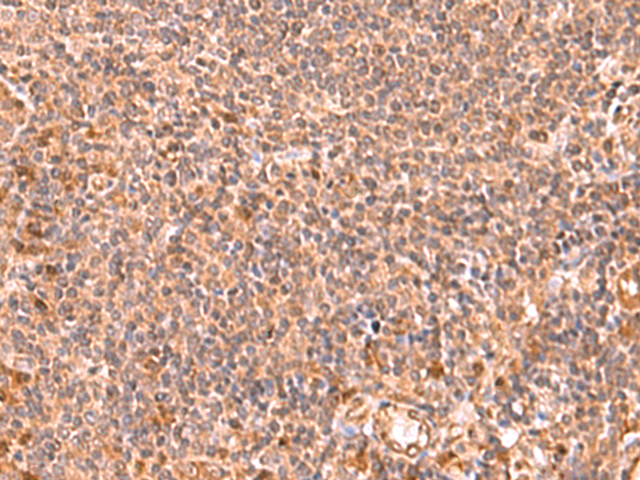 Immunohistochemistry of paraffin-embedded Human tonsil tissue  using RABEPK Polyclonal Antibody at dilution of 1:85(×200)