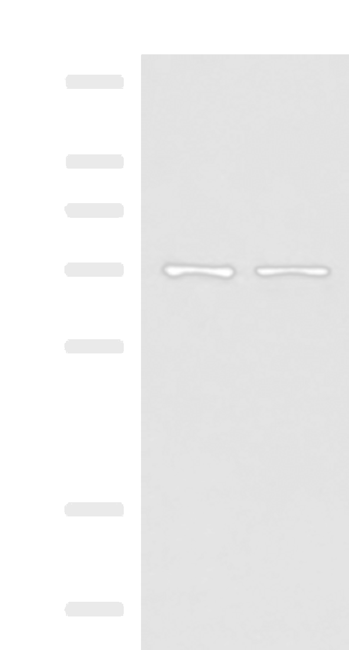 Western blot analysis of Mouse liver tissue and Jurkat cell lysates  using MKS1 Polyclonal Antibody at dilution of 1:700