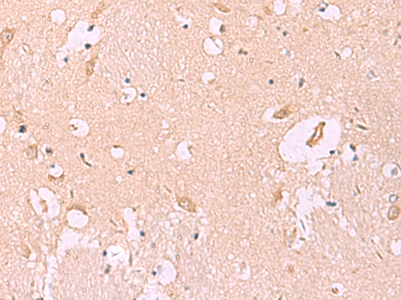 Immunohistochemistry of paraffin-embedded Human brain tissue  using MKS1 Polyclonal Antibody at dilution of 1:50(×200)