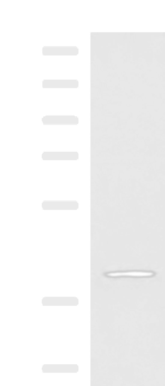 Western blot analysis of TM4 cell lysate  using RAB3IL1 Polyclonal Antibody at dilution of 1:600