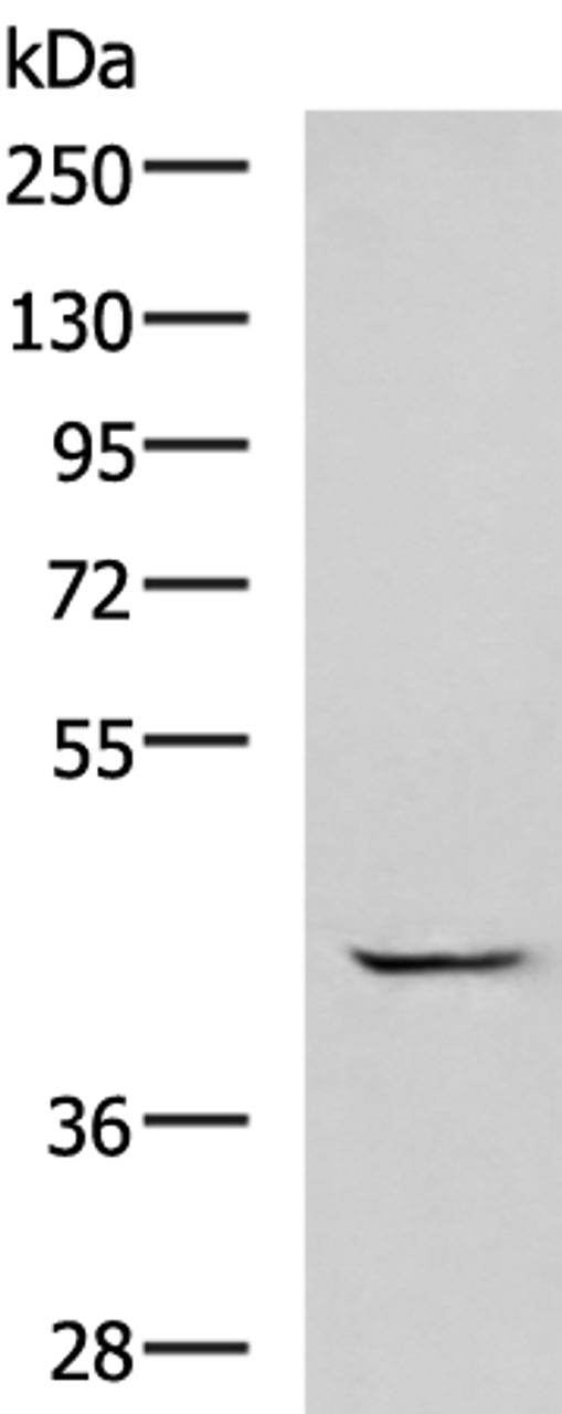 Western blot analysis of A549 cell lysate  using GABPB1 Polyclonal Antibody at dilution of 1:1000