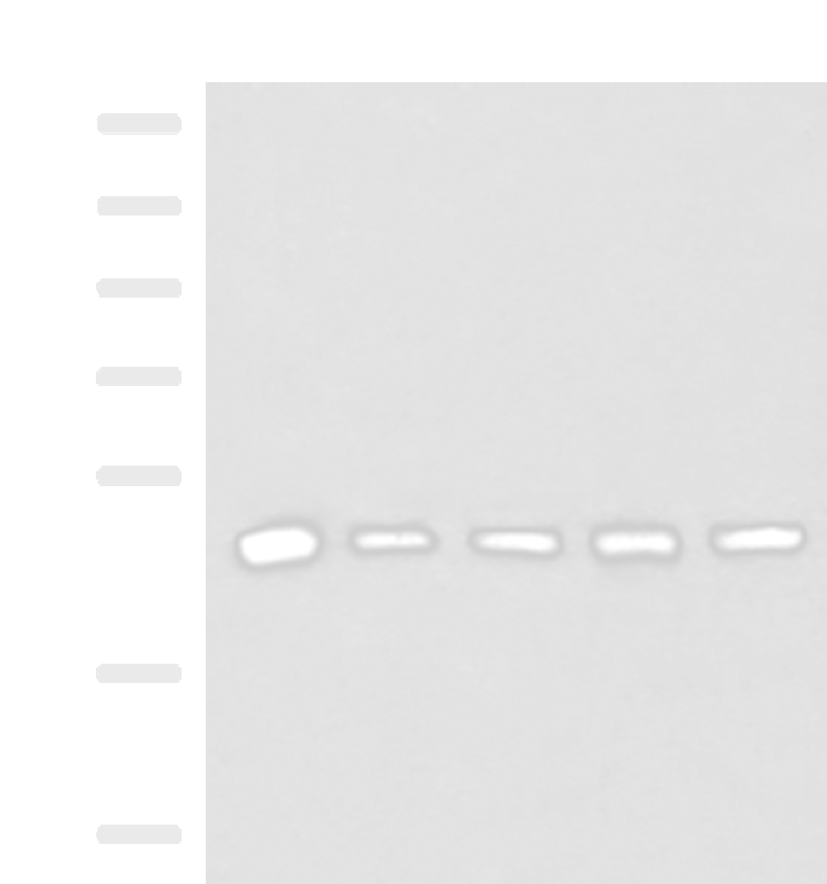 Western blot analysis of Human fetal liver tissue HepG2 A172 Hela and Jurkat cell lysates  using PCYT2 Polyclonal Antibody at dilution of 1:800