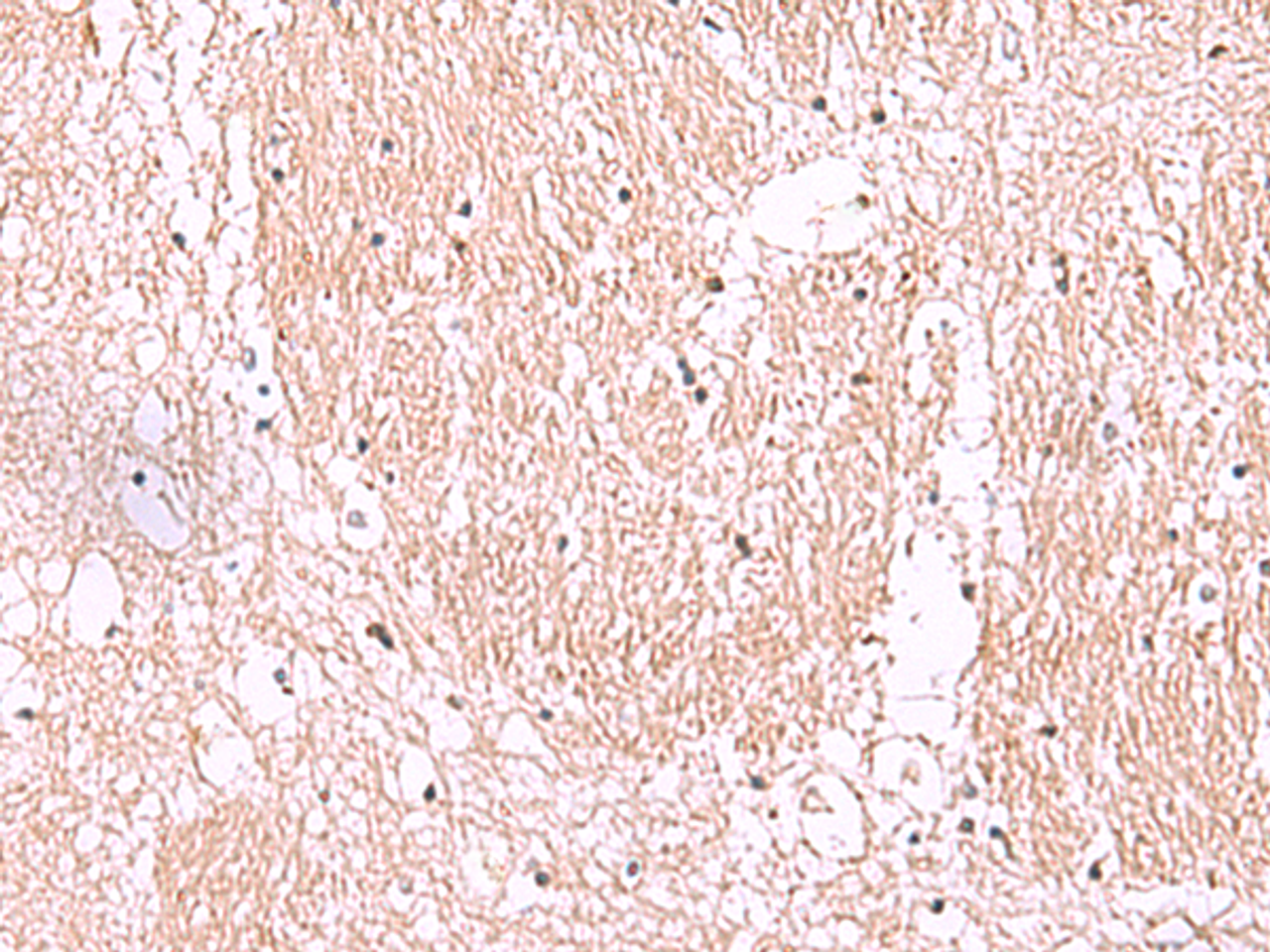 Immunohistochemistry of paraffin-embedded Human brain tissue  using RIC8A Polyclonal Antibody at dilution of 1:55(×200)