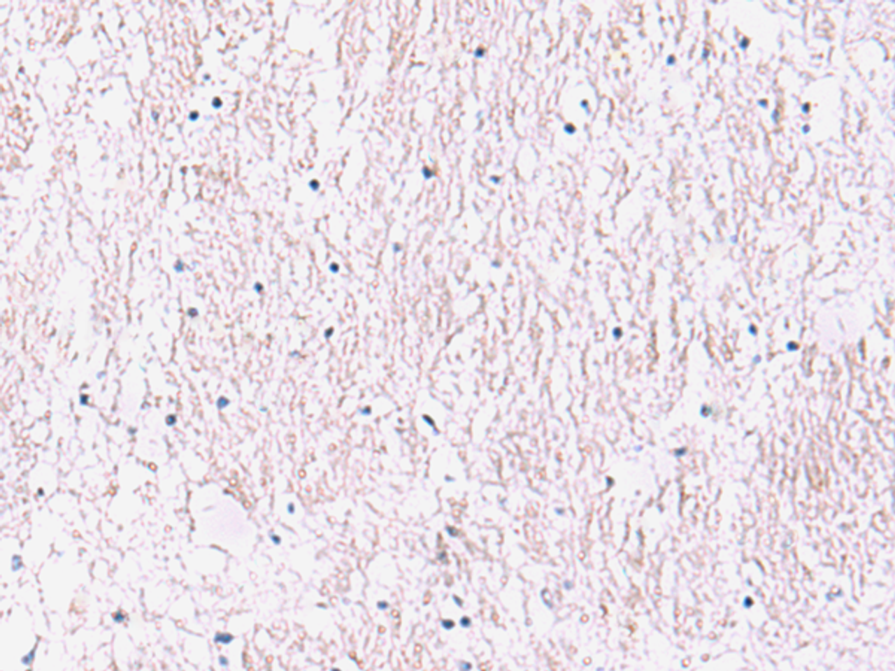 Immunohistochemistry of paraffin-embedded Human brain tissue  using SMPD2 Polyclonal Antibody at dilution of 1:90(×200)