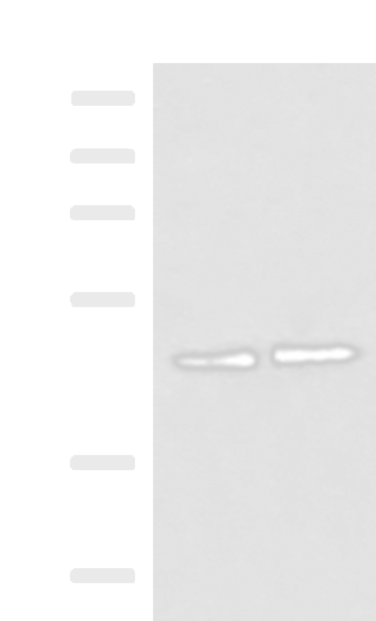 Western blot analysis of Hela and HepG2 cell lysates  using ACTL6B Polyclonal Antibody at dilution of 1:1000