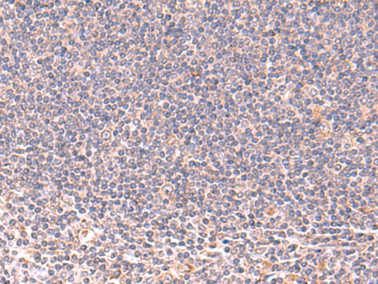 Immunohistochemistry of paraffin-embedded Human tonsil tissue  using MANSC1 Polyclonal Antibody at dilution of 1:105(×200)