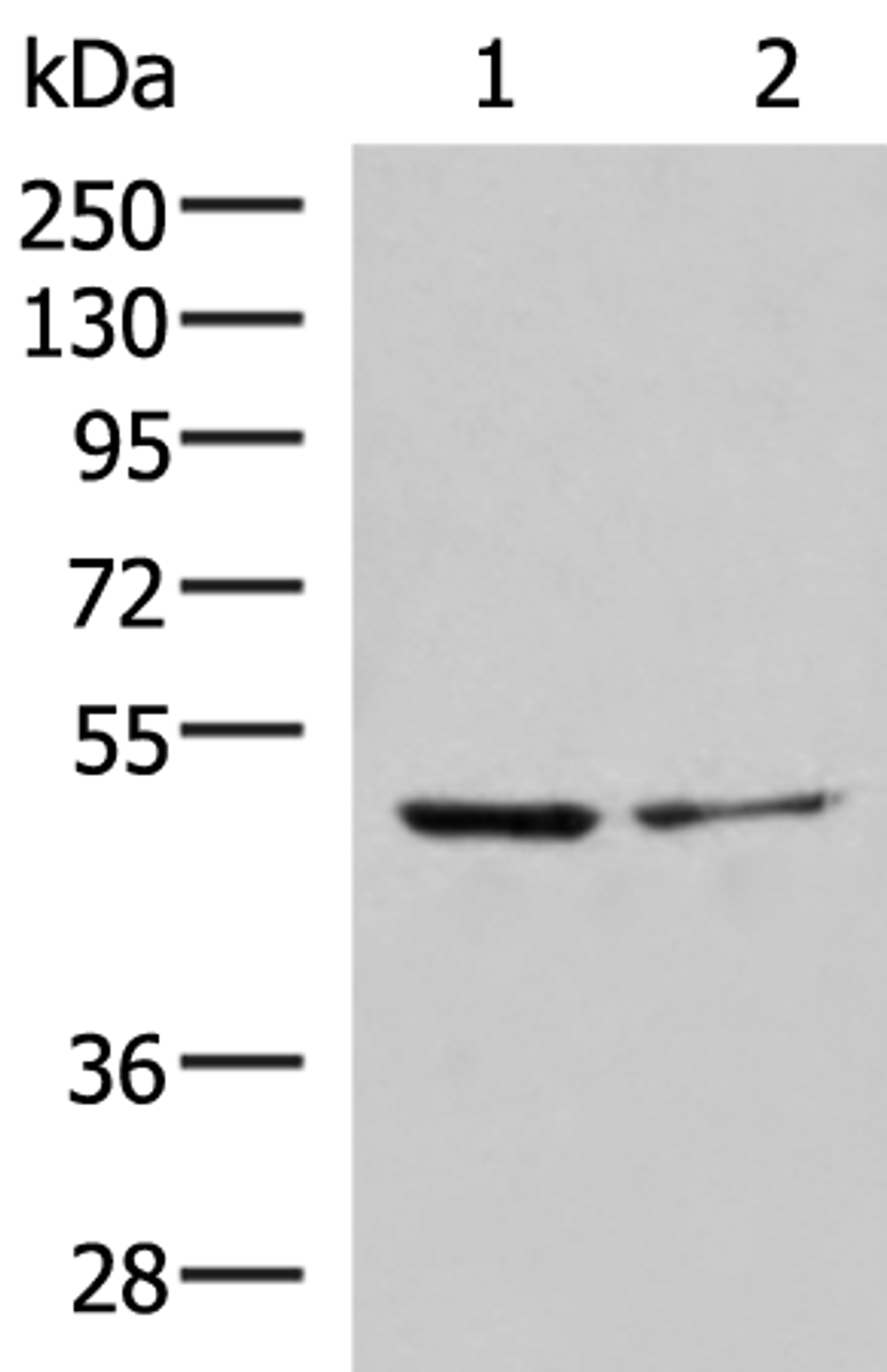 Western blot analysis of Jurkat and HepG2 cell lysates  using ECSIT Polyclonal Antibody at dilution of 1:1000