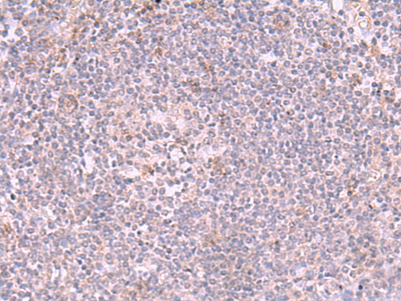 Immunohistochemistry of paraffin-embedded Human tonsil tissue  using INPP5K Polyclonal Antibody at dilution of 1:90(×200)
