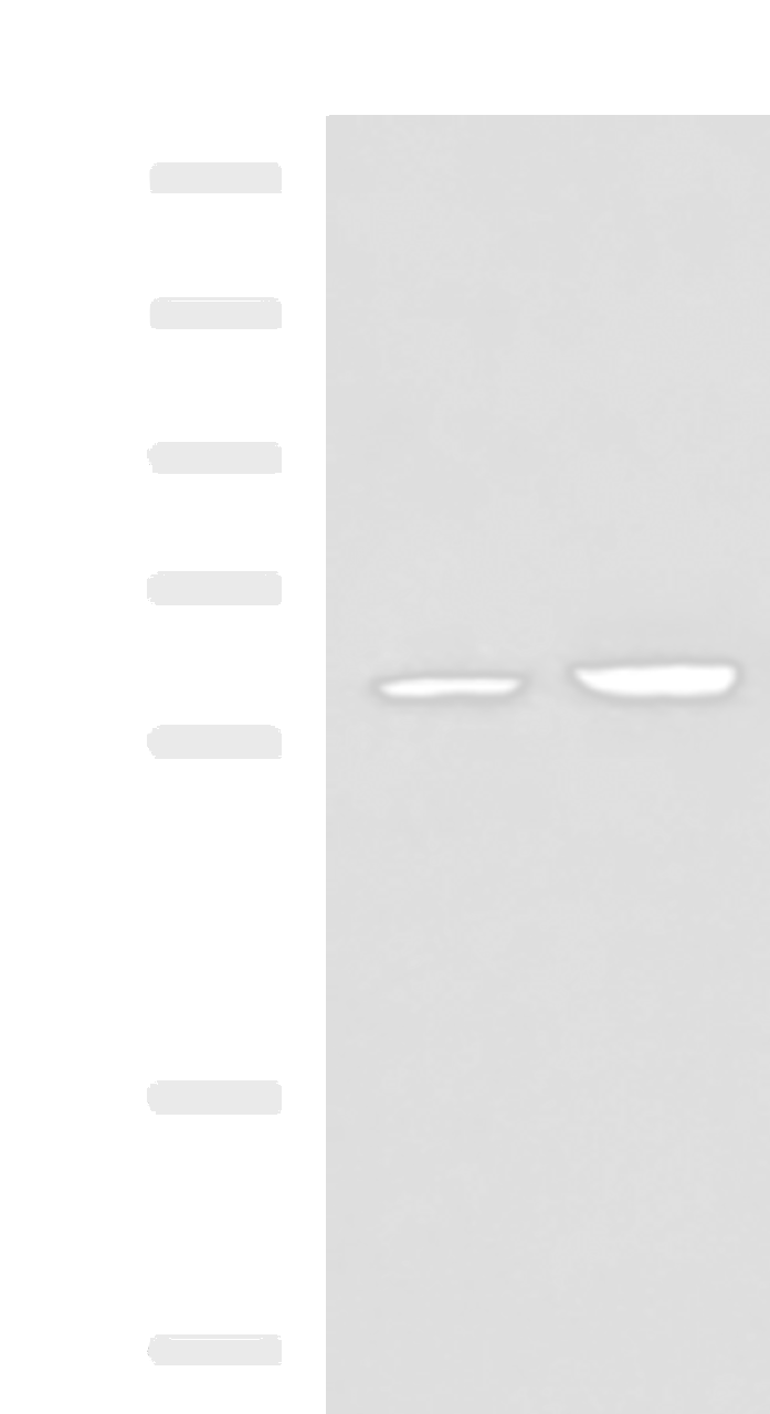 Western blot analysis of 231 and HepG2 cell lysates  using FKBP4 Polyclonal Antibody at dilution of 1:900