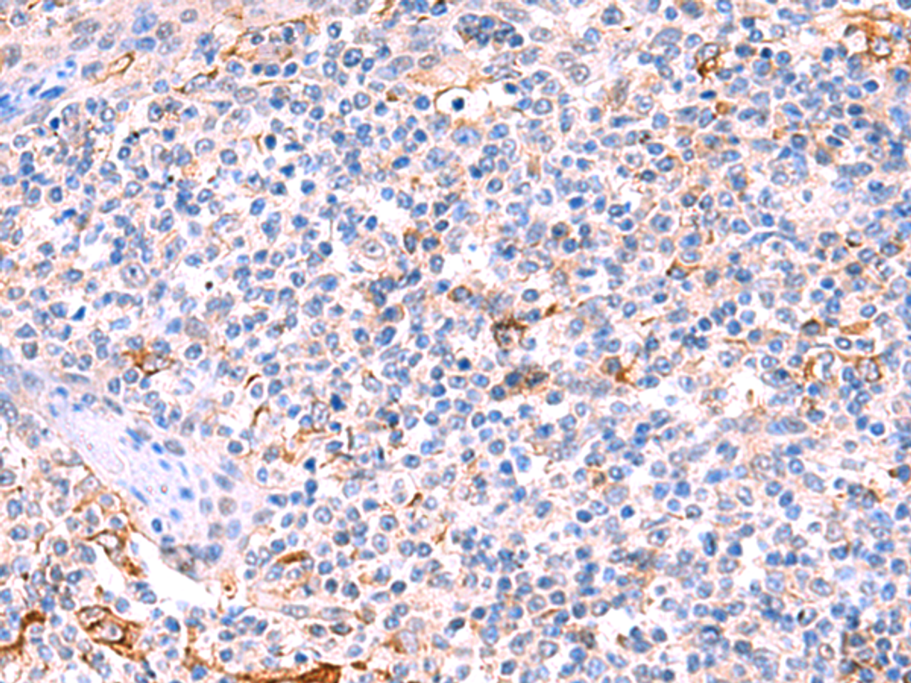 Immunohistochemistry of paraffin-embedded Human tonsil tissue  using FUCA2 Polyclonal Antibody at dilution of 1:70(×200)