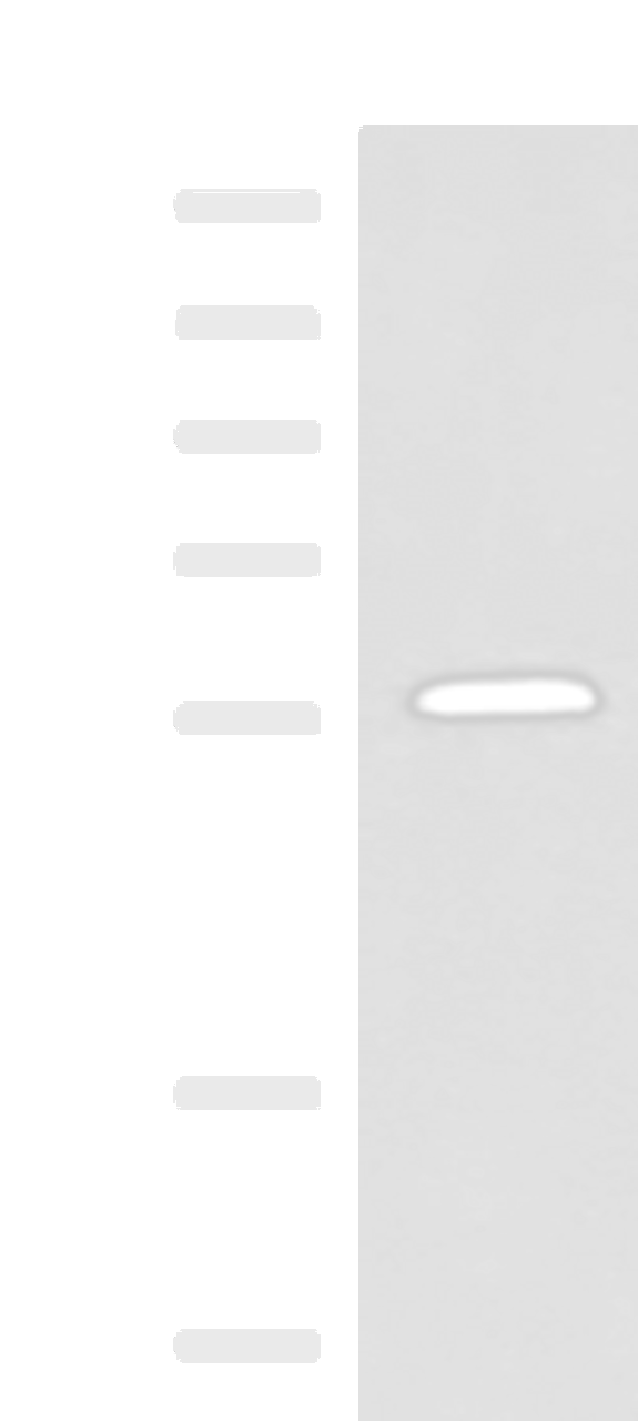 Western blot analysis of Mouse small intestines tissue lysate  using PEPD Polyclonal Antibody at dilution of 1:1000